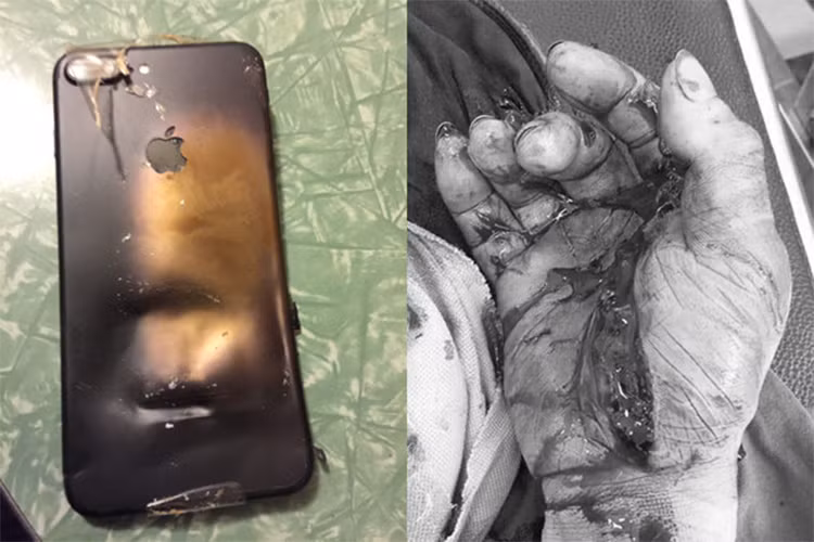 Những lần điện thoại nổ khi đang sạc khiến người dùng tử vong Nhung lan dien thoai no khi dang sac khien nguoi dung tu vong