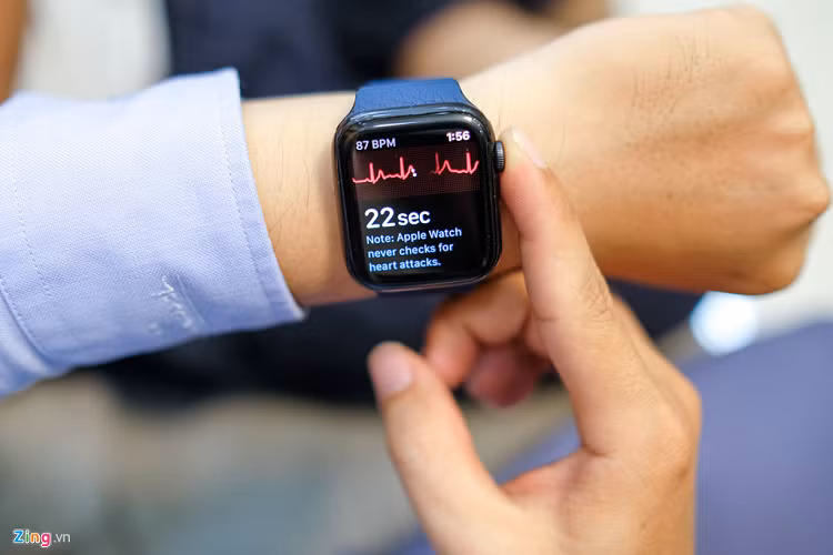 Người dùng có thể kích hoạt chức năng chụp điện tâm đồ (EKG) bằng cách chạm vào nút Digital Crown bên cạnh. 