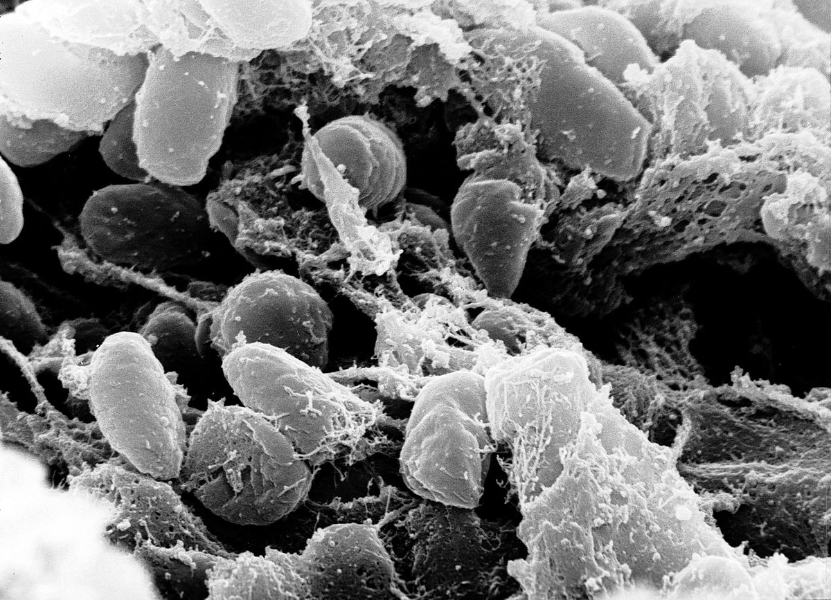 Các nhà khoa học đã sử dụng kính hiển vi để phát hiện ra rằng vi khuẩn Yersinia pestis là nguyên nhân gây ra dịch hạch.