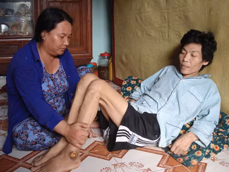 Theo thống kê của Phòng LĐTB &amp; XH huyện Bình Sơn và Lý Sơn, trung bình mỗi năm có 15 vụ ngư dân gặp nạn khi lặn đánh bắt hải sâm trên biển, trong đó không ít người phải bỏ mạng hoặc bị các tai biến sống thực vật. Ảnh: Thợ lặn Trần Đình Lộc, 45 tuổi, ở thôn Tây, xã An Hải, huyện Lý Sơn (Quảng Ngãi), bị liệt sau khi gặp tai nạn trong chuyến lặn biển năm 2006 (Nguồn: Sài Gòn tiếp thị).