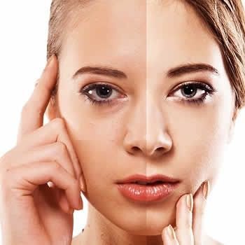 Sự tích tụ của các tế bào da chết trên khuôn mặt của bạn có thể làm cho làn da của bạn trông xỉn màu, bong tróc hoặc lão hóa sớm. Vì vậy, tẩy da chết cũng là việc bạn cần phải thực hiện nếu muốn có làn da khỏe mạnh. Ảnh: samaa.