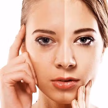 Sự tích tụ của các tế bào da chết trên khuôn mặt của bạn có thể làm cho làn da của bạn trông xỉn màu, bong tróc hoặc lão hóa sớm. Vì vậy, tẩy da chết cũng là việc bạn cần phải thực hiện nếu muốn có làn da khỏe mạnh. Ảnh: samaa.