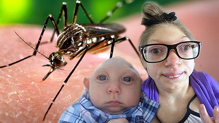 Virus Zika thậm chí còn có liên quan đến một số dị tật bẩm sinh ở trẻ em khi nó ảnh hưởng đến phụ nữ mang thai. Ảnh: anninhthudo.