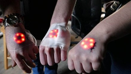 Dù quá trình tiểu phẫu vô cùng đau đớn do vùng da tại mu bàn tay mỏng, có nhiều mạch máu nhưng không ít bạn trẻ vẫn tỏ ra rất hào hứng với thú chơi mới rùng rợn này.