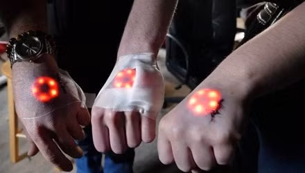 Dù quá trình tiểu phẫu vô cùng đau đớn do vùng da tại mu bàn tay mỏng, có nhiều mạch máu nhưng không ít bạn trẻ vẫn tỏ ra rất hào hứng với thú chơi mới rùng rợn này.