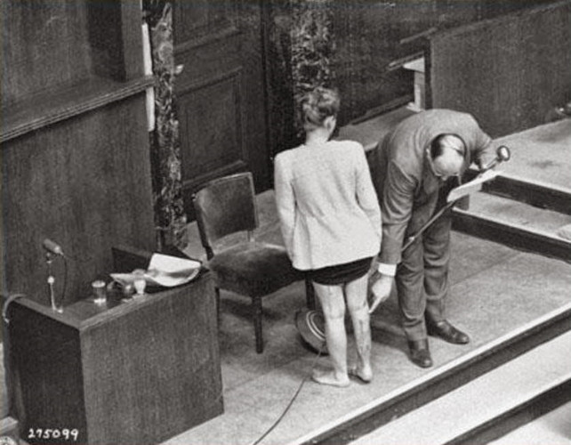 Những vết sẹo trên chân của người phụ nữ Ba Lan Jadwiga Dzido vì bị đem ra làm "vật thí nghiệm" trong trại tập trung Ravensbruck.