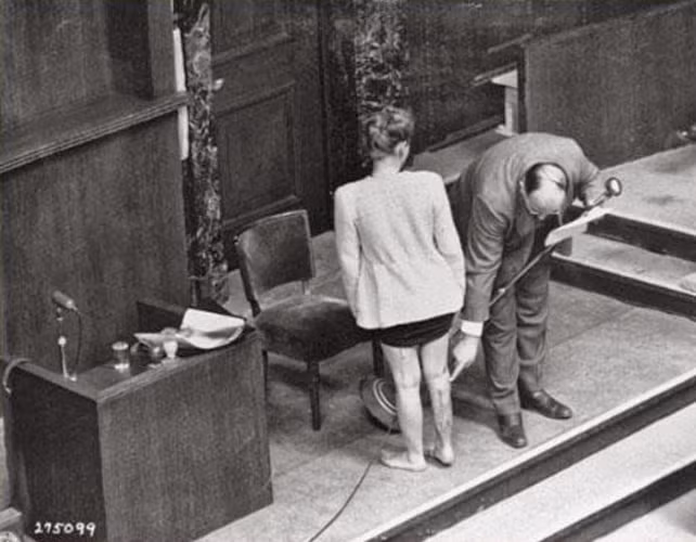 Những vết sẹo trên chân của người phụ nữ Ba Lan Jadwiga Dzido vì bị đem ra làm "vật thí nghiệm" trong trại tập trung Ravensbruck.