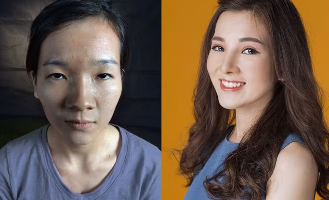 Bị gia đình người yêu ngăn cấm, nhà tuyển dụng từ chối vì ngoại hình kém xinh, đặc biệt là đôi mắt "lươn", Lương Thị Hà (sinh viên năm 4, Đại học Y khoa Vinh, Nghệ An) từng gây "bão mạng" sau khi phẫu thuật thẩm mỹ.