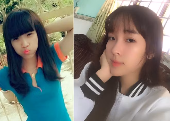 Không hài lòng với tất cả đường nét trên gương mặt, đuôi mắt cụp, sụp mí, cằm ngắn, khuôn miệng kém duyên, bạn bè thường trêu chọc khiến Thúy Huyền (sinh năm 1995, Rạch Giá, Kiên Giang) tự ti, thu mình lại và ngại tiếp xúc với mọi người xung quanh. Sau khi tâm sự với mẹ và nhận được sự ủng hộ của gia đình, 9X đã thực hiện các phẫu thuật trượt hàm, cắt mí, cắt môi và tạo má lúm đồng tiền.