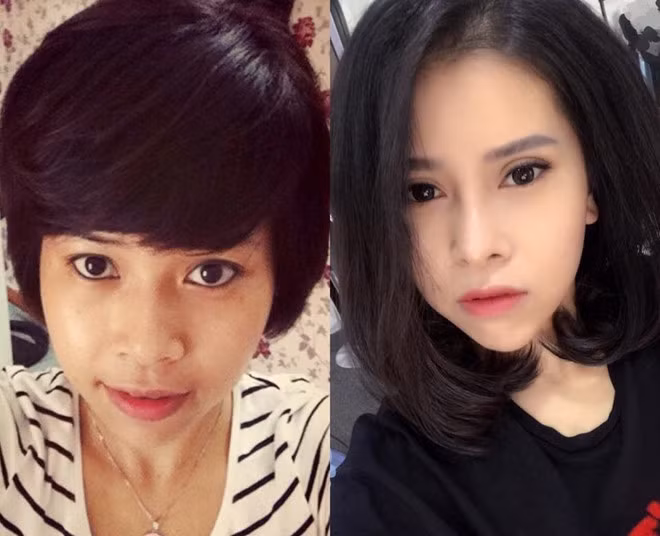 Quan niệm, phụ nữ lúc nào cũng phải đẹp, sống vui vẻ, chăm chút cho bản thân thật nhiều, đặc biệt là sau khi ly hôn nên bà mẹ đơn thân Kim Ngân (sinh năm 1986, Hà Nội) quyết định phẫu thuật thẩm mỹ. Ngân Kim cho hay chị đã chi hơn 40 triệu đồng để "trùng tu nhan sắc".