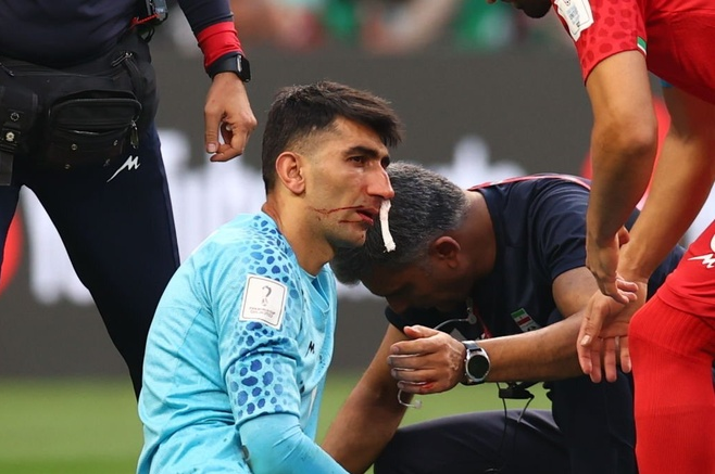 Một trong những pha chấn thương kinh hoàng ở World Cup 2022 phải kể đến sự cố gãy mũi Thủ môn Alireza Beiranvand của Iran.