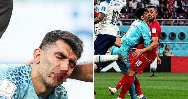 Sự cố này của Alireza Beiranvand là mất mát rất lớn với đội tuyển Iran.
