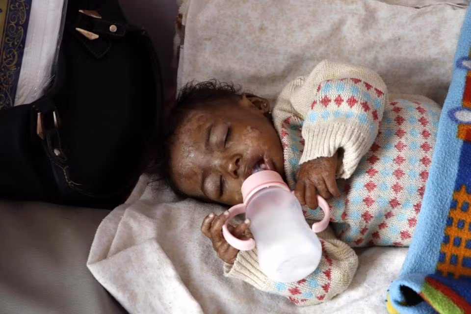 Chien tranh lien mien, hang trieu tre Yemen bi suy dinh duong-Hinh-4