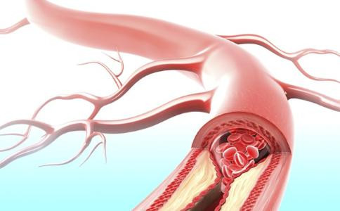Ngăn ngừa chứng xơ cứng động mạch bằng cách sớm phát hiện và điều trị sớm bệnh cao huyết áp, mỡ máu, béo phì và nhiều bệnh khác. Ảnh: 99.