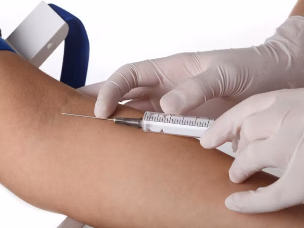 Xét nghiệm đông máu. Xét nghiệm này sẽ giúp bạn biết trước để đề phòng trong trường hợp bị rối loạn chảy máu vì máu không đông hoặc khó đông.