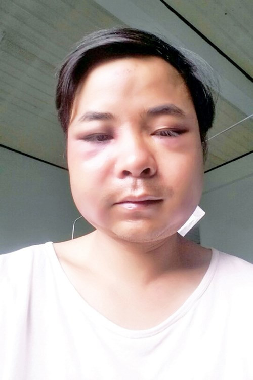 Danh kiem lam thua song thieu chet vi bi kiem tra-Hinh-2