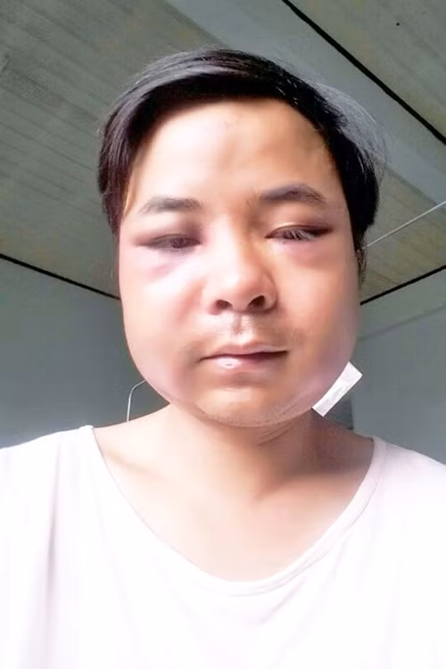 Danh kiem lam thua song thieu chet vi bi kiem tra-Hinh-2