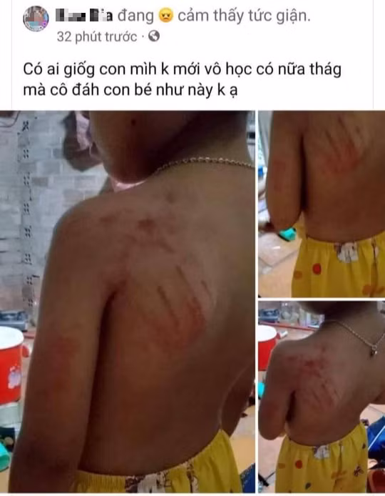  Cô giáo đánh học sinh lớp 1 bầm tím: Chiều 14/9, tại Trường Tiểu học Bàu Lâm (xã Bàu Lâm, huyện Xuyên Mộc, tỉnh Bà Rịa-Vũng Tàu) trong tiết học môn Tiếng Việt. Học sinh này chậm tiếp thu bài giảng, viết bài chậm nên bị cô giáo dùng tay đánh vào tay và vai trái gây vết bầm tím. Sau khi nắm được thông tin, Ban Giám hiệu đã tổ chức họp hội đồng xử lý kỷ luật đối với giáo viên này. Được biết, giáo viên sau đó cũng trực tiếp xin lỗi gia đình, phía gia đình cũng chấp nhận, hiện sức khỏe cháu đã ổn định. 