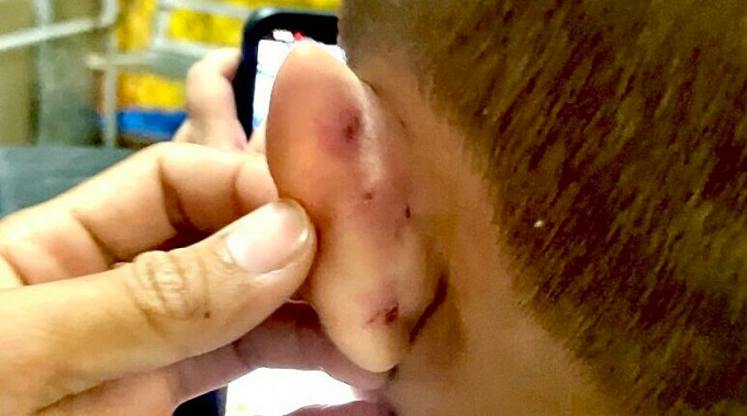  Cô giáo mầm non bạo hành trẻ lúc đút cơm: Ngày 6/3, Công an TP. Rạch Giá (Kiên Giang) đã khởi tố bị can đối với Đoàn Thị Thương (24 tuổi) - giáo viên cơ sở mầm non Phù Đổng, tọa lạc đường Lâm Quang Ky, TP. Rạch Giá. Bà Thương đã có hành vi đánh bé T.T.M (4 tuổi) gây thương tích. Theo đó, trong nhiều ngày liền, bé M bị cô Thương bạo hành bằng nhiều cách khác nhau như dùng tay đánh, dùng muỗng ngoáy vào miệng, dùng tay véo tai làm bé té ngã xuống nền gạch. Vành tai bên trái của bé bị trầy xước, chảy máu. 