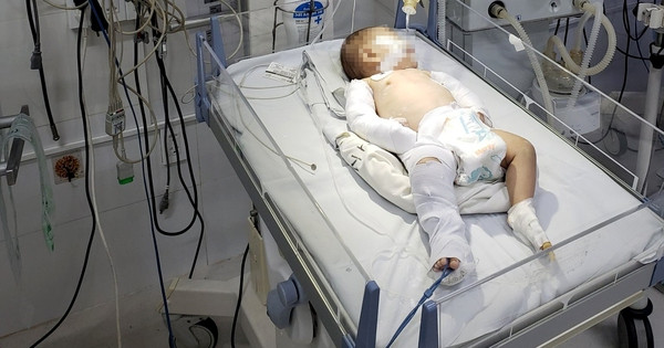 Bé 2 tháng tuổi bị bạo hành ở Lâm Đồng: Mẹ và người tình xử sao? Be 2 thang tuoi bi bao hanh o Lam Dong: Me va nguoi tinh xu sao?