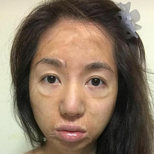 Mặt nạ "lão hóa" Hanacure có hình dạng và cách dùng tương đối khác biệt so với các loại mặt nạ khác. Ảnh: trantoanphat.