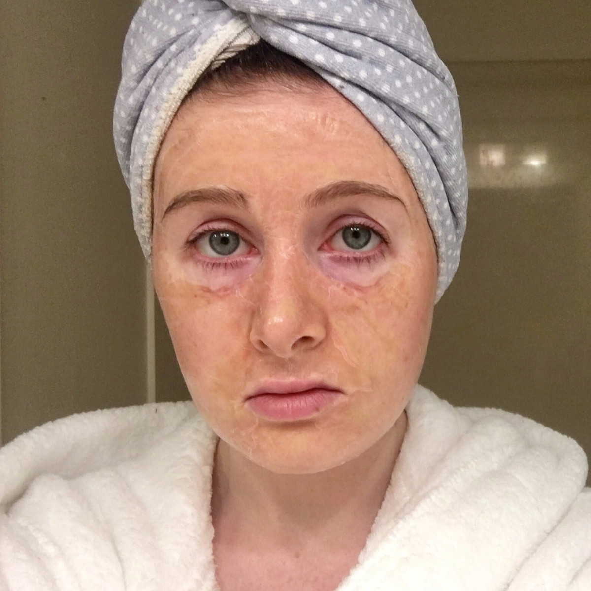 Đây là loại mặt nạ dạng gel. Khi thoa lên mặt và khô lại, nó sẽ dính chặt lấy da mặt bạn. Khi bạn cử động cơ mặt, lớp mặt nạ này sẽ nứt toác ra và khiến da mặt bạn nhăn nheo như cụ già. Ảnh: popsugar.