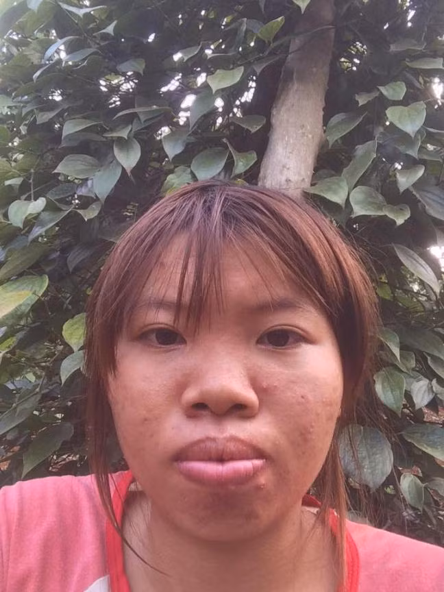 Phuong Thi No cong khai y dinh nang nguc, sua rang