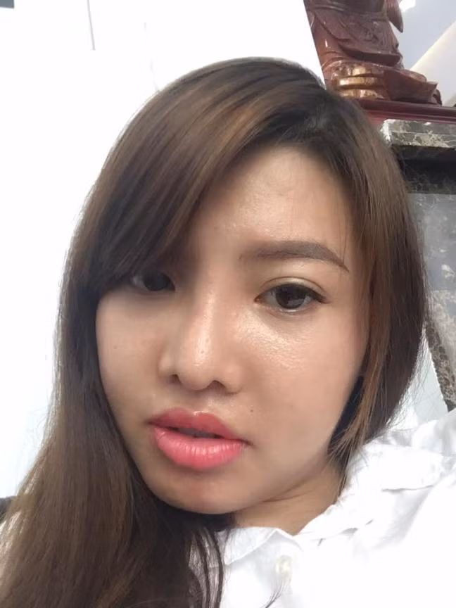 "Bố mẹ nào chẳng thương con, khi em đại phẫu thì mẹ em khăn gói đi theo, lần sau phẫu thuật mũi thì mình em đi. Em nhấn mí, làm mũi, xăm môi, phun chân mày…ở lại 1 ngày sau đó rồi về. Em không có ý định làm cằm nhưng sẽ suy nghĩ về việc nâng ngực, làm răng…Do sinh nở rồi nên không được như con gái, em muốn chờ ổn định nhan sắc rồi sửa lại chút nữa. Phẫu thuật xong, em xin ba mẹ lên Sài Gòn sống, em muốn học thêm để sau này em có kiến thức riêng. Ngày xưa em chỉ học đến lớp 8 nên em muốn học thêm về phần văn hóa, học bổ túc lại cũng như những môn năng khiếu. Nguồn tài chính hiện tại, em đang dự định bán hàng online hoặc mở cửa hàng nho nhỏ. Tiền bây giờ của em tiết kiệm, tiền riêng, em đang lo cuộc sống trên này, sau này có thu nhập, em sẽ đưa con gái em vào Sài Gòn. Từ lúc li hôn, 2 vợ chồng không liên lạc, gặp nhau cũng coi như không quen biết".