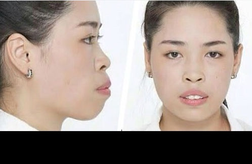 Trước khi trở thành nhân vật trong chương trình Thay đổi cuộc sống mùa đầu tiên, Vũ Thanh Quỳnh có một khuôn mặt thực sự bị cho là xấu xí và một hoàn cảnh gia đình rất khó khăn. Sinh ra và lớn lên trong một gia đình nghèo ở Nam Định, có ý thức và nỗ lực vươn lên nhưng với ngoại hình không ấn tượng, Thanh Quỳnh luôn gặp khó khăn khi đi xin việc làm. Đam mê ngành thiết kế thời trang nhưng do chính bản thân cũng không có được vẻ ngoài ưa nhìn nên trong suốt một thời gian dài, cô gái Nam Định không có được cơ hội phát triển công việc và tạo ra thu nhập ổn định để phụ giúp gia đình.