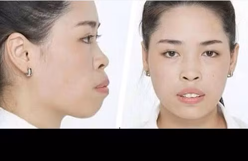 Trước khi trở thành nhân vật trong chương trình Thay đổi cuộc sống mùa đầu tiên, Vũ Thanh Quỳnh có một khuôn mặt thực sự bị cho là xấu xí và một hoàn cảnh gia đình rất khó khăn. Sinh ra và lớn lên trong một gia đình nghèo ở Nam Định, có ý thức và nỗ lực vươn lên nhưng với ngoại hình không ấn tượng, Thanh Quỳnh luôn gặp khó khăn khi đi xin việc làm. Đam mê ngành thiết kế thời trang nhưng do chính bản thân cũng không có được vẻ ngoài ưa nhìn nên trong suốt một thời gian dài, cô gái Nam Định không có được cơ hội phát triển công việc và tạo ra thu nhập ổn định để phụ giúp gia đình.