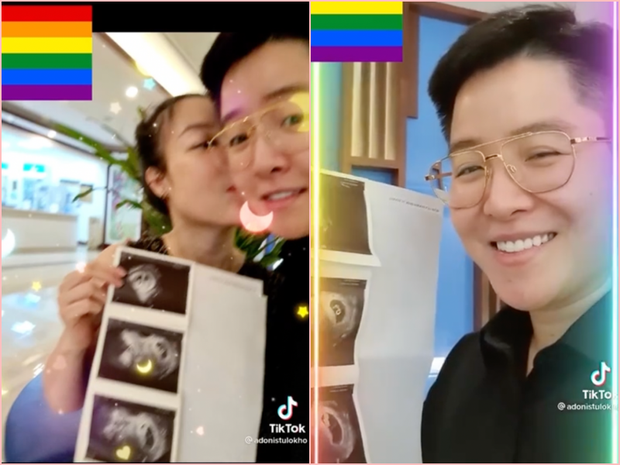 Mới đây, nam thần chuyển giới này bất ngờ xuất hiện lại và thông báo tin mừng đến mọi người là vợ đại gia đã mang song thai.