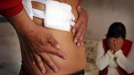 Kinh hai phat hien mat than sau ca phau thuat nguc