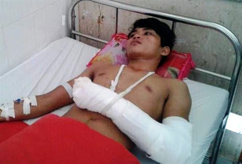 Ngan khach xem phim den, chu quan bi chem