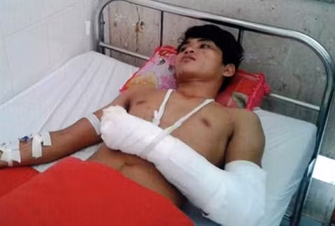 Ngan khach xem phim den, chu quan bi chem