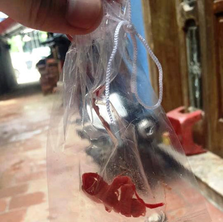 Benh nhan to bac si bo quen bong trong vet thuong-Hinh-2