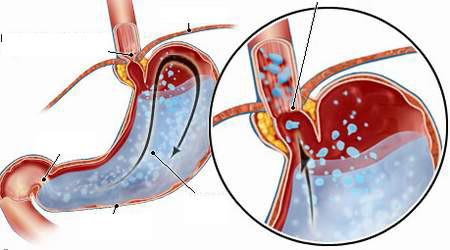 Giai đoạn thứ 2 bao gồm các enzyme - chất xúc tác sinh học làm tăng tốc độ phản ứng hóa học. Enzyme sẽ phân hủy thức ăn thành các chất dinh dưỡng để cơ thể bạn có thể sử dụng. Giai đoạn thứ ba, các axit dạ dày được tạo thành từ các axit clohidric và muối tiếp tục quá trình tiêu hóa. Cuối cùng, bã còn xót lại ra xuống ruột già và thải qua đường đại tiện.
