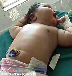 Dù cân nặng của bé sơ sinh này đạt mức kỷ lục nhưng các bác sĩ khẳng định sức khỏe của bé hoàn toàn khỏe mạnh và không hề mắc chứng tiểu đường. Hiện tại, em bé đang được theo dõi sức khỏe tại bệnh viện trước khi đưa về với mẹ. Các bác sĩ cho biết bé không có vấn đề gì về sức khỏe như lượng đường trong máu không đều hay có vấn đề về tuyến giáp.