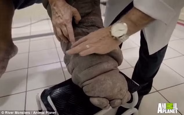 Hiện tại, chân ông đã phù to đến mức ông không thể đi lại như bình thường.