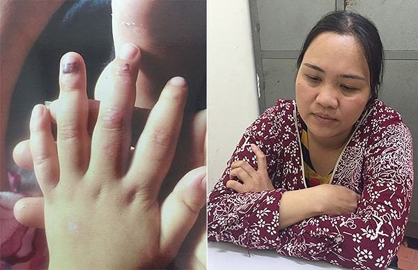 Bà Hải (bìa phải) đã hành hạ con gái người tình; trong đó đánh làm các ngón tay trẻ bầm dập (bìa trái). *ảnh: Nguyệt My