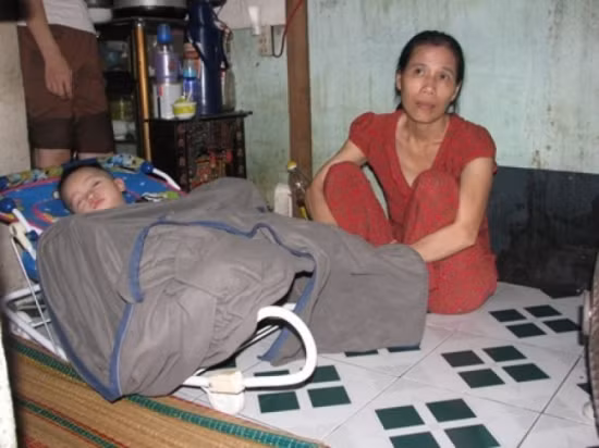  2. Căn nhà "hộp diêm" - 4m2 Nằm cuối con hẻm phía sau lưng chợ Cồn (TP Đà Nẵng) là ngôi nhà ẩm thấp, tối thui của chị Lê Thị Xí (sinh 1967, tổ 11, phường Hải Châu 2, quận Hải Châu, TP Đà Nẵng). Ngôi nhà được khoảng hơn 4m2 là nơi tá túc của 6 con người. Các không gian sinh hoạt được bố trí ngặt nghèo theo hướng chất chồng lên để tiết kiệm diện tích. Ảnh: Giadinh.net.