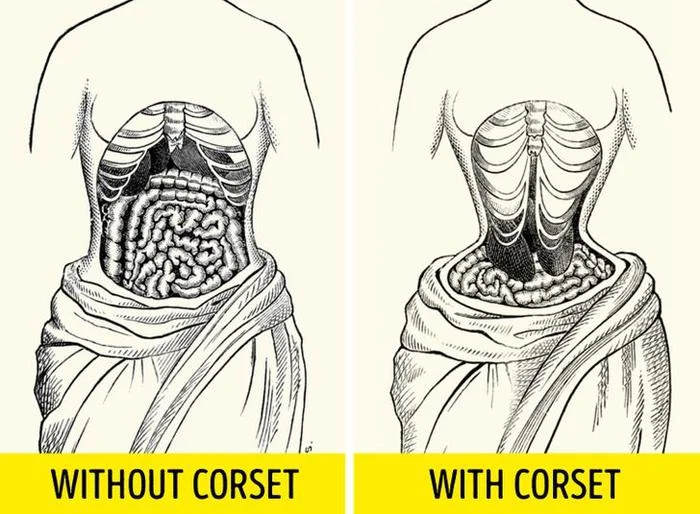 4. Corset (áo nịt) chặt đến nỗi thay đổi vị trí nội tạng của phụ nữ: Áo nịt ngực của họ chặt đến nỗi gây ra teo cơ, thay đổi hình dạng của xương ngực và thay đổi vị trí nội tạng. Vị trí nội tạng của phụ nữ thế kỷ 19 không giống với người phụ nữ hiện đại.