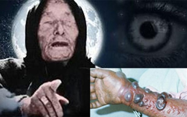 1. Đại dịch Ebola: Năm 2014, đại dịch Ebola bắt đầu hoành hành ở châu Phi và lây lan sang 1 số quốc gia ở châu Á khiến cả nghìn người thiệt mạng. Nhiều người cho rằng dự đoán của nhà tiên tri mù Vanga đã ứng nghiệm.