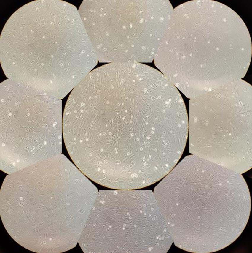 Tế bào nội mô: Những tế bào nội mô (endothelial cells) được tách khỏi máu người, rồi được chụp bằng smartphone với sự trợ giúp của một kính hiển vi, hệ số phóng đại 20x.