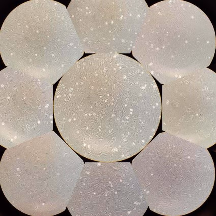 Tế bào nội mô: Những tế bào nội mô (endothelial cells) được tách khỏi máu người, rồi được chụp bằng smartphone với sự trợ giúp của một kính hiển vi, hệ số phóng đại 20x.