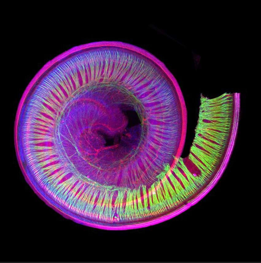 Đường xoắn âm thanh: Ốc tai là chặng cuối cùng âm thanh vượt qua để đến dây thần kinh thính giác; trong ảnh ốc tai được tô màu bởi phương pháp hóa miễn dịch tế bào (immuno-histochemistry). Phần màu đỏ thể hiện những tế bào lông, chuyển đổi âm thanh thành tín hiệu thần kinh (dây thần kinh màu xanh lục).