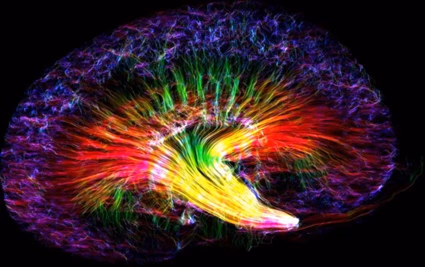 Cầu vòng thận: Ảnh thận của chuột này được chụp bởi kỹ thuật MRI khuếch tán, cho thấy các hướng lan chảy của các phân tử nước. Nhờ vậy ta trông thấy các ống thận, lọc máu để cho ra nước tiểu. Ảnh đẹp của Niang Wang, thuộc Đại học Duke (Mỹ), đoạt giải nhất kèm số tiền thưởng 550 euro.