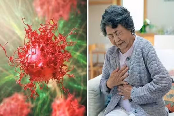 Dấu hiệu phổ biến nhất của ung thư di căn Dau hieu pho bien nhat cua ung thu di can