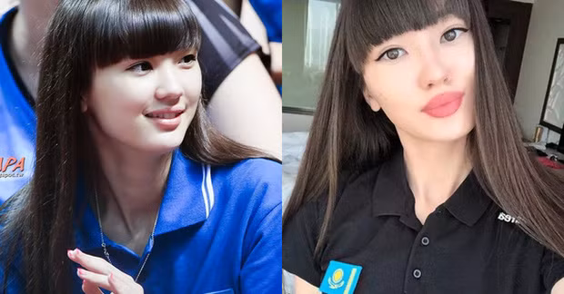 Sau khi nổi tiếng, chỉ một thời gian người hâm mộ bất ngờ trước những hình ảnh mới của Sabina. Thời điểm đó, VĐV bóng chuyền dính nghi vấn đã đụng chạm “dao kéo” khi liên tục xuất hiện với gương mặt có phần cứng đơ và khác lạ.