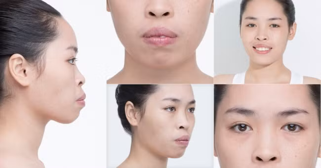 Một hot girl khác cũng từng gây chú ý trong chương trình "Người ấy là ai" là Vũ Thanh Quỳnh. Cô được biết đến với biệt danh "hot girl thẩm mỹ" sau màn "lột xác" ngoạn mục về diện mạo.