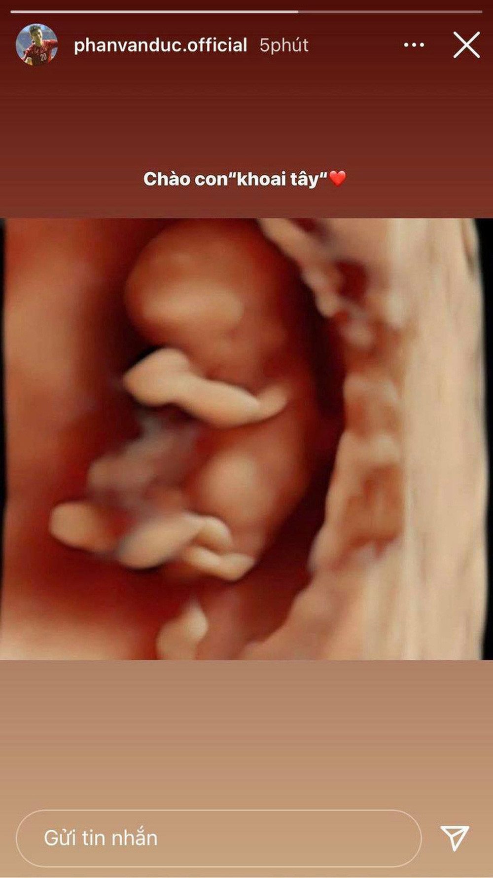 Trên trang cá nhân, cầu thủ Phan Văn Đức đăng ảnh siêu âm em bé cùng dòng trạng thái: "Chào con, Khoai Tây". Vậy là ngay sau Bùi Tiến Dũng, ĐT Việt Nam có thêm một thành viên chuẩn bị gia nhập hội "hai con".
